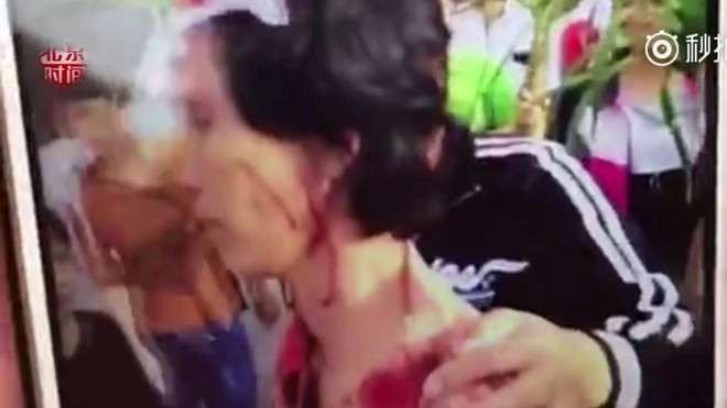 Vô tình hắt nước vào giày người qua đường, nhân viên bị đánh tới nhập viện Ảnh 2