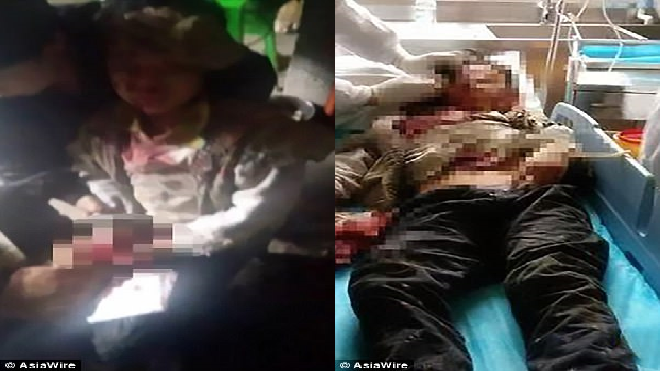 Dùng điện thoại lúc đang sạc, cậu bé nhận cái kết kinh hoàng sau tiếng nổ lớn Ảnh 2