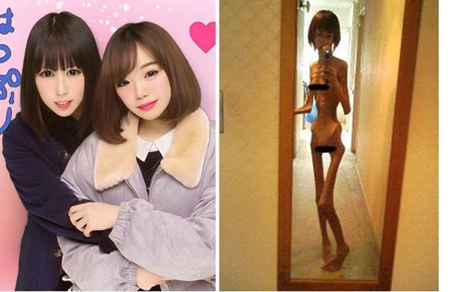 Sốc: Cô gái trẻ thân hình gầy xác ve vì bị ông nội bỏ đói Ảnh 2