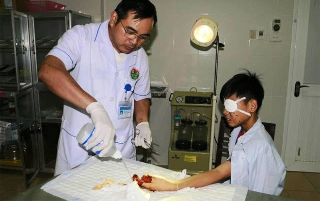 Học sinh lớp 2 bị thương nặng do nghịch pháo Ảnh 2