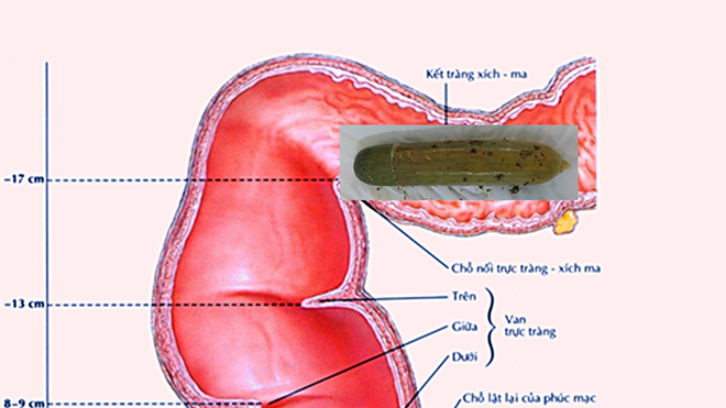 Một bác sĩ phải cấp cứu vì lọt cả quả dưa leo vào bụng Ảnh 2