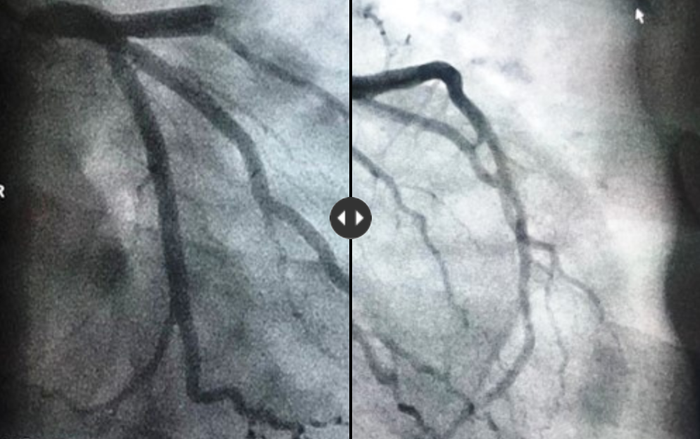 Ông cụ suýt chết sau chén rượu mừng tân niên Ảnh 2