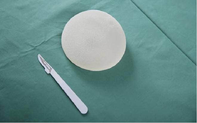 Nơi đầu tiên trên thế giới nâng ngực miễn phí cho người nghèo Ảnh 2