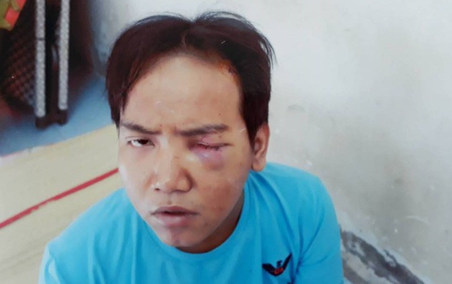 Bảo vệ dân phố sát hại bé trai 6 tuổi ở Sài Gòn bị tâm thần phân liệt Ảnh 2