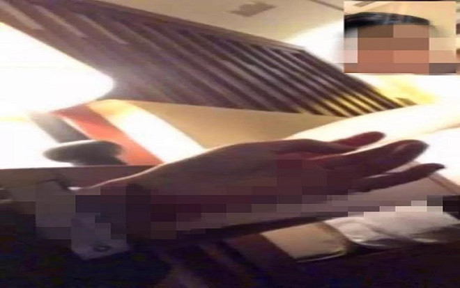 Thất tình, cô gái gọi video call cho bạn trai cũ để chứng kiến cảnh cắt tay tự tử Ảnh 2