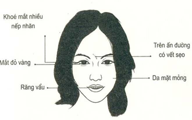 Nhân tướng học: Những đặc điểm xấu trên gương mặt phụ nữ Ảnh 2