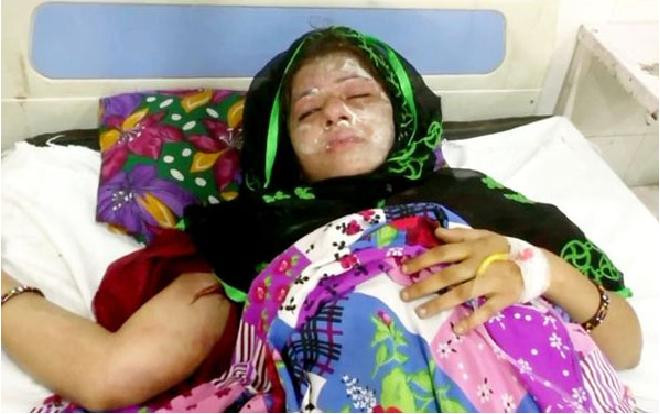 Chồng nhẫn tâm tạt axit vợ vì lúc đang ngủ vì sinh hai con gái Ảnh 2