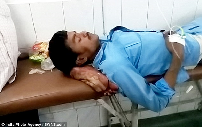 Phẫn nộ bác sĩ để bệnh nhân gối đầu bằng chính chân bị gãy thay vì nối liền ngay lập tức Ảnh 2