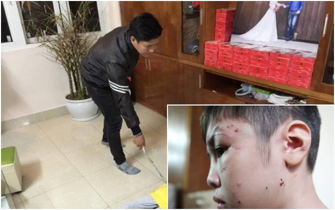 Người cha đánh dã man con trai 10 tuổi bị truy tố thêm tội danh Ảnh 2