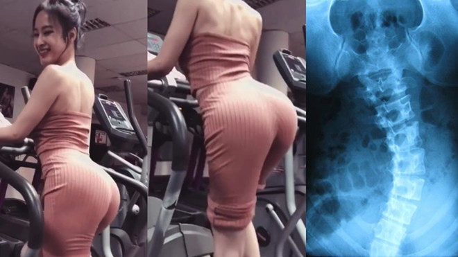 Angela Phương Trinh khiến mọi người lo 'gãy cột sống' vì quá dẹo khi hướng dẫn bài tập Step giúp tăng vòng 3 Ảnh 2