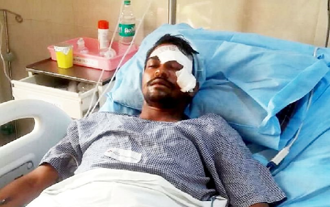 Bị dao đâm xuyên mắt, người đàn ông vẫn sống sót thần kỳ Ảnh 2