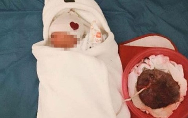 Làm rõ thông tin mẹ con sản phụ tử vong vì theo trào lưu 'sinh thuận tự nhiên' Ảnh 2