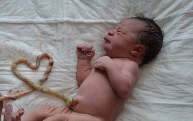 Bệnh viện Từ Dũ vào cuộc vụ sản phụ được cho là đẻ ở nhà 'thuận tự nhiên' khiến hai mẹ con tử vong Ảnh 2