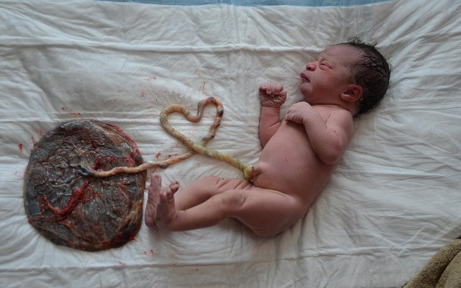 Bộ Y tế đề nghị xử lý người đăng tải thông tin mẹ con sản phụ tử vong do sinh ‘thuận tự nhiên’ Ảnh 2