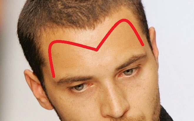 Nhân tướng học: Người có trán hình này không sớm thì muộn cũng giàu 'nứt đố đổ vách' Ảnh 2