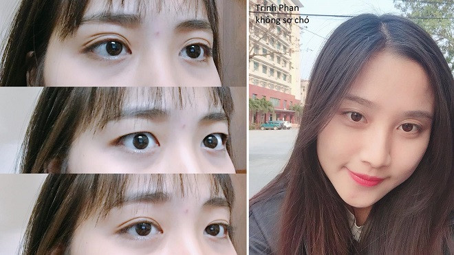 Cư dân mạng thi nhau khoe ảnh 'mắt có tận 2,3,4 mí' lại còn thay đổi theo cảm xúc Ảnh 2