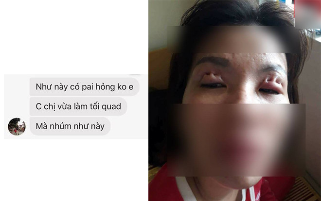 Cảm thấy hơi sai cô gái lên mạng hỏi mình nhấn mí 'thế này có phải hỏng không' Ảnh 2