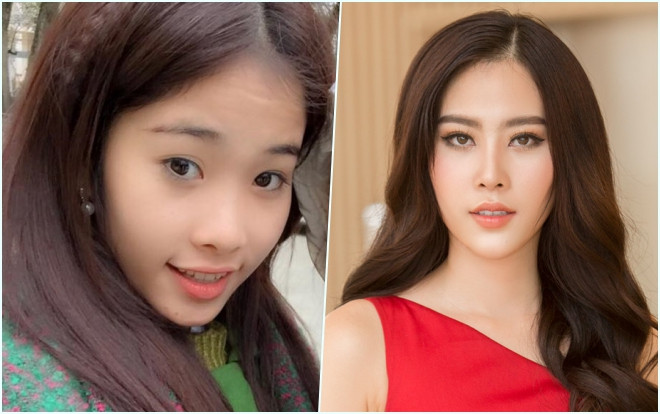 Hậu scandal tình cảm với Trường Giang, Nam Em tiếp tục bị soi phẫu thuật thẩm mỹ Ảnh 2