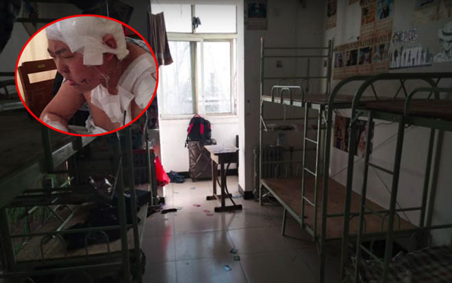 Bị phàn nàn ngủ ngáy và xì hơi, nam sinh dùng dao đâm bạn cùng phòng thừa sống thiếu chết Ảnh 2
