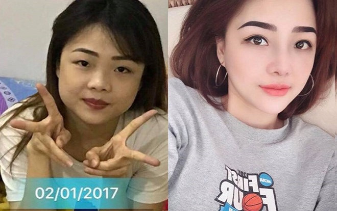 Cô gái mắt một mí 'đập mặt làm lại' trở nên xinh đẹp như hotgirl Ảnh 2