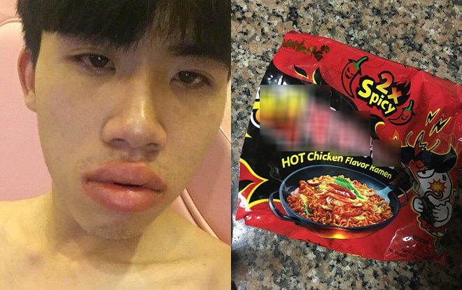 Trên đời có kiểu người không ăn được cay, một tý thôi cũng đủ để 'môi tều' Ảnh 2