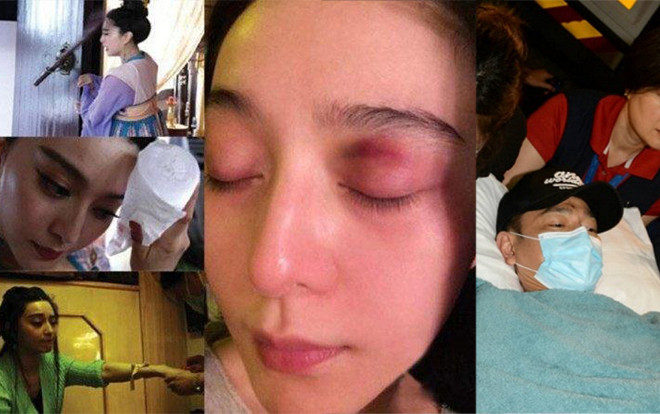 Fan đau lòng khi biết được những chấn thương mà thần tượng phải âm thầm chịu đựng Ảnh 2