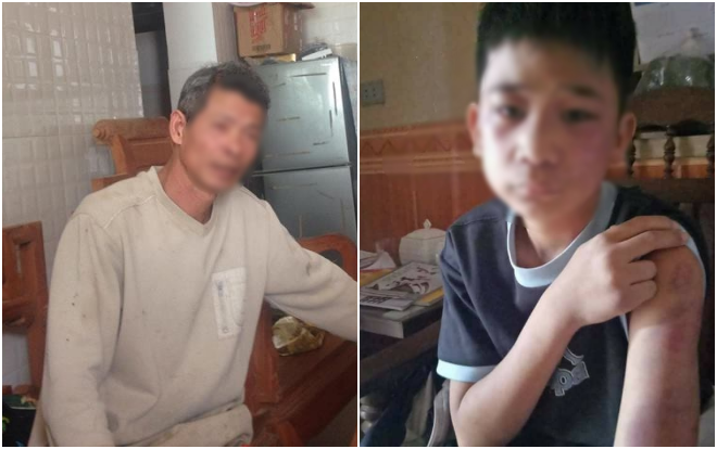 Vụ bé trai 14 tuổi bị bố và mẹ kế bạo hành: 'Nhiều lần thấy cháu bị đánh, cấm không cho chơi với ai' Ảnh 2