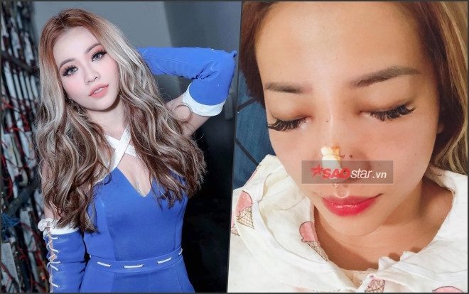 Bất ngờ lộ ảnh MiA phẫu thuật thẩm mỹ Ảnh 2