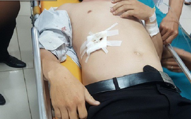 Bị nhắc nhở xóa hình xăm, nam sinh đâm thầy trọng thương rồi bỏ trốn Ảnh 2