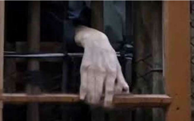 Cha nhốt con trai trong lồng hơn 20 năm Ảnh 2