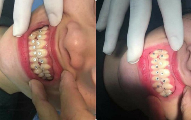 'Nụ cười tỏa nắng' của cô nàng khiến ai nấy đều 'gục ngã' Ảnh 2