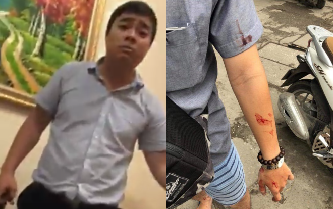 Nữ sinh viên cùng bạn bị giám đốc trung tâm dạy gia sư đánh chảy máu phải nhập viện Ảnh 2