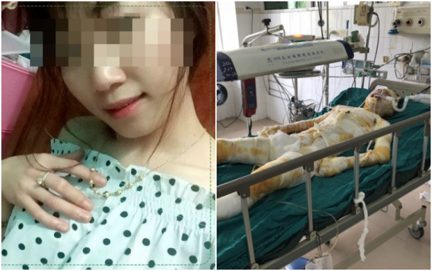 Cô gái bị bạn trai tẩm xăng thiêu sống tại phòng trọ đã qua đời Ảnh 2