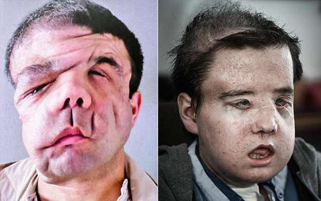 Người đàn ông có 3 khuôn mặt: ‘Nó là tôi và mọi chuyện đang dần tốt lên’ Ảnh 2