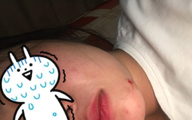 Xôn xao hình ảnh cô gái bị 'kẻ biến thái' dí dao vào cổ, dùng roi chích điện ép quan hệ Ảnh 2