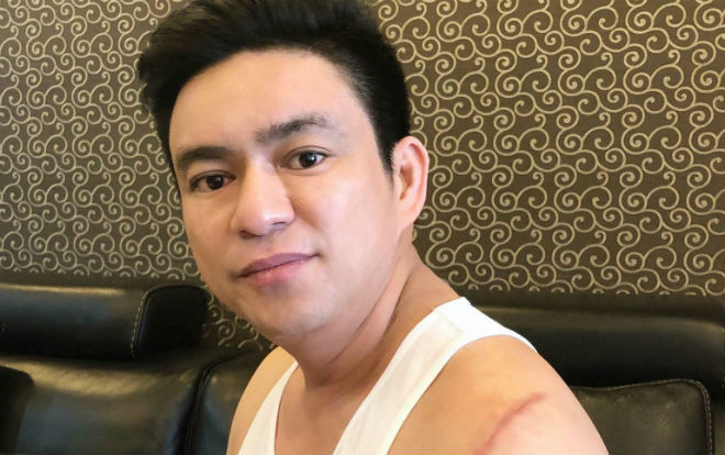 Bác sĩ Chiêm Quốc Thái bị nhóm người mang hung khí chém trọng thương ở Phố đi bộ Ảnh 2