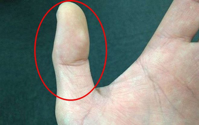 Nhìn độ dài hai đốt ngón tay cái biết ngay tình duyên lận đận hay suôn sẻ Ảnh 2