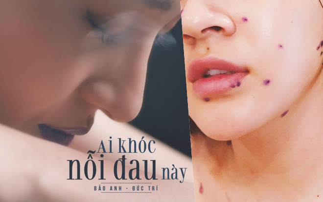 Hủy show vì bị thủy đậu, Bảo Anh lập tức có quà 'trấn an' fan ngay trong cơn bệnh Ảnh 2