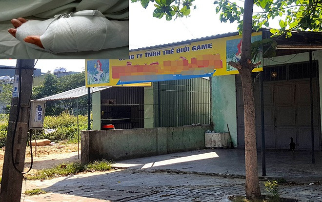 Hé lộ nguyên nhân vụ cô gái bị chém lìa bàn tay ở quán game Ảnh 2