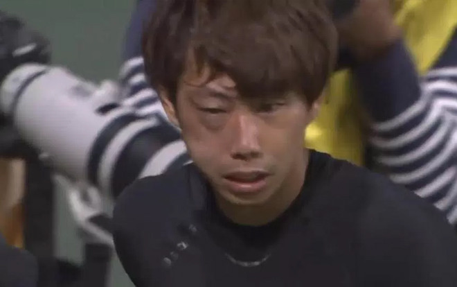 Va chạm kinh hoàng, thủ môn Nhật Bản gãy xương mặt có nguy cơ lỡ World Cup Ảnh 2