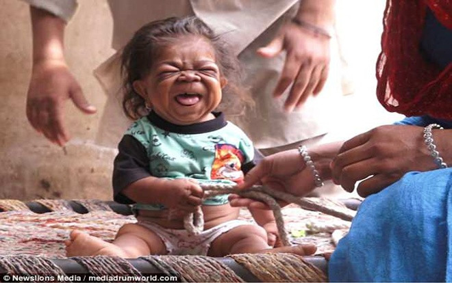 Chàng trai 23 tuổi mắc kẹt trong thân hình 'cậu bé tí hon' Ảnh 2