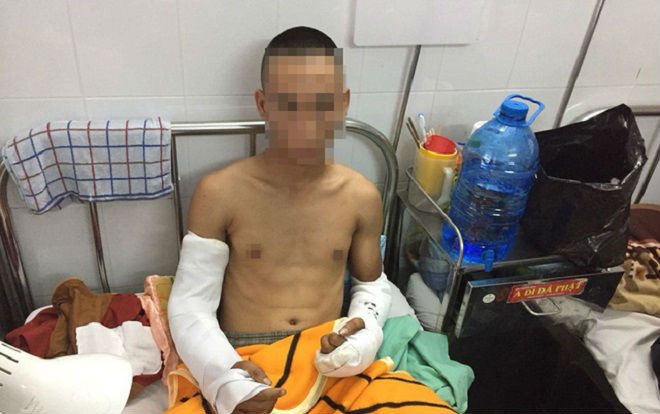 Ngồi uống cà phê, 3 thanh niên bị nhóm côn đồ chém trọng thương vùng đầu, đứt gân 2 cánh tay Ảnh 2