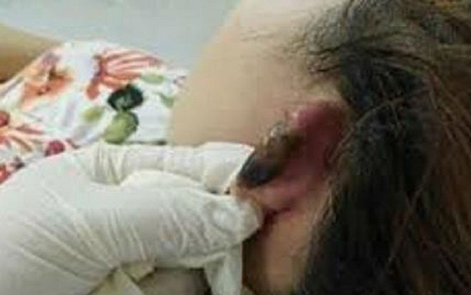 Khởi tố nhóm thanh niên chích điện, cắt vành tai cô gái vì món nợ 20 triệu đồng Ảnh 2