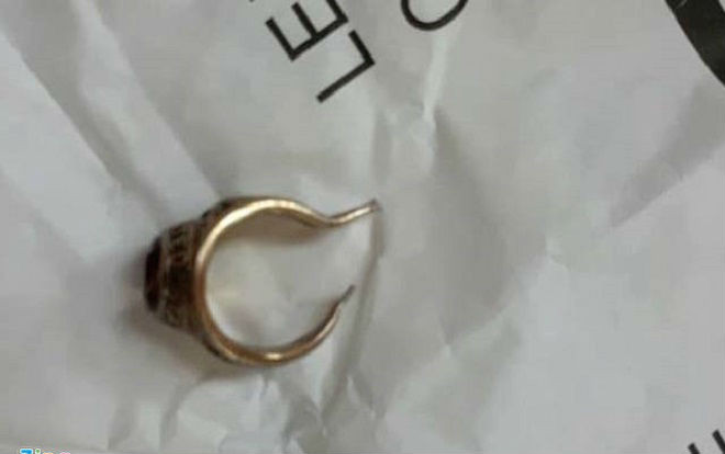 Suýt bị hoại tử vì đeo nhẫn cho 'của quý' Ảnh 2