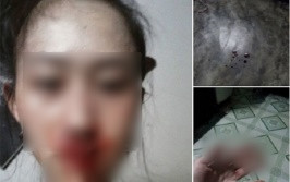 Bị đánh gãy xương mũi, con gái đau đớn viết tâm thư tố bị chính cha ruột bạo hành Ảnh 2