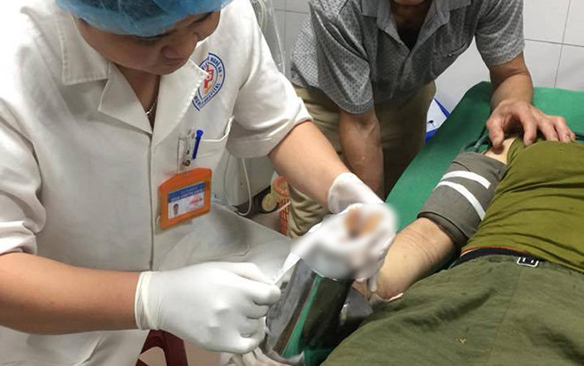 Một phụ nữ bị dập nát cả cánh tay vì bị cuốn vào cối xay thịt Ảnh 2