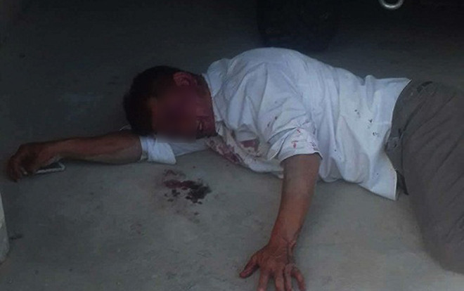 Điều tra vụ người đàn ông bị đánh chấn động não vẫn không được đưa đi cấp cứu Ảnh 2
