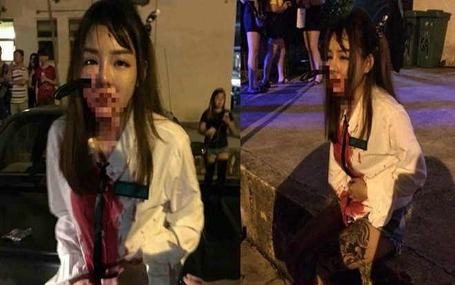 Cô gái bị đâm dao thẳng mặt vẫn bình tĩnh gọi cảnh sát Ảnh 2