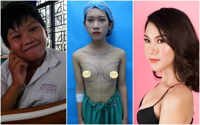 Hành trình đưa thân xác về với giới tính thật của cô nàng từng bị mẹ đuổi ra khỏi nhà vì đòi… phẫu thuật Ảnh 2