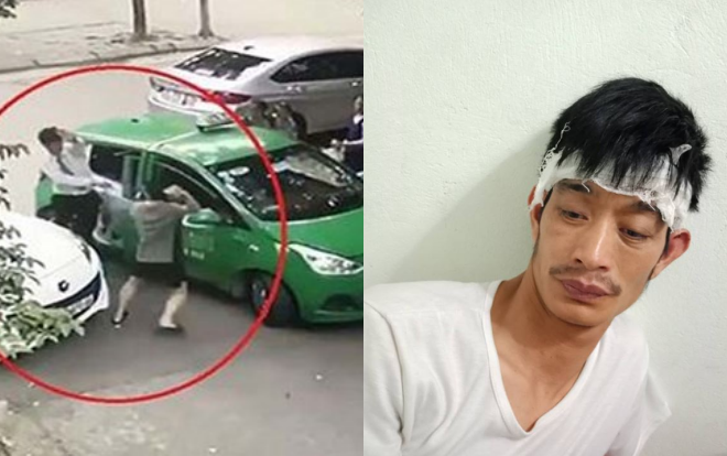 Luật sư tự nguyện bào chữa miễn phí cho tài xế taxi bị người đàn ông đi Mercedes đánh chảy máu đầu Ảnh 2